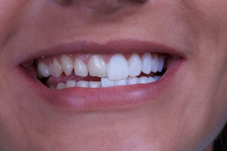 The Role of Dental Clinics in Maintaining Oral Health